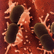 escherichia_e_coli_infection-1.jpg