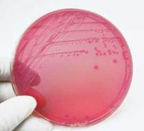 E-coli-2.jpg